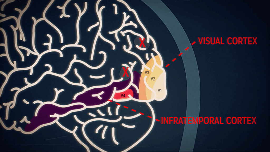 Ilustrasi Otak Menyaring Informasi